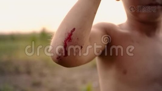 孩子`手上有一个新鲜的小擦伤，跌倒后男孩`胳膊肘受伤，孩子手上有血视频