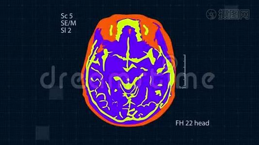 脑MRT扫描。 全高清医学背景.. 无缝循环视频