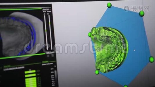 未来牙齿假体计算机模型的建立视频