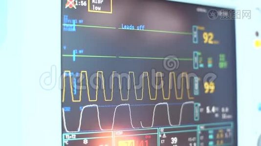 数字心脏监测器读出接近线图形和数字显示的病人被测量。 数字视频