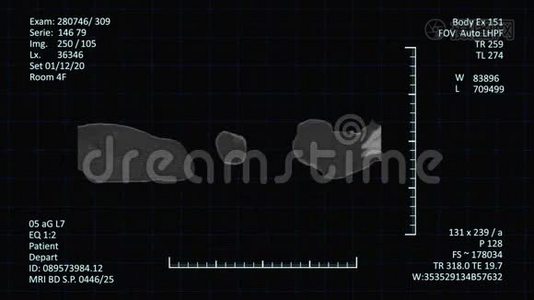 核磁共振扫描监视器与CT图像视频