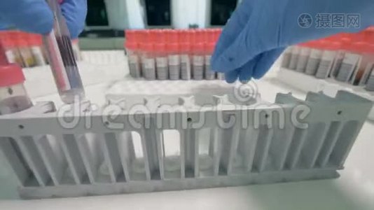 科学家用血液样本填满一个架子，关闭。视频