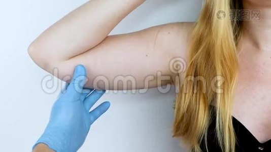 一位整形外科医生正准备收紧手部皮肤。 腕管成形术-塑料手臂，手上挂着皮肤视频