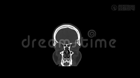 健康男性头部计算机医学断层扫描视频