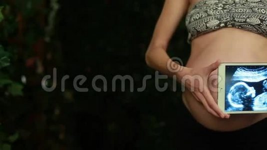 孕妇婴儿超声波照片视频