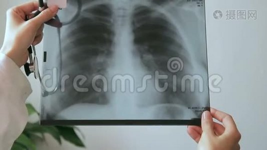 医生手里拿着一张人体胸部x光照片。视频