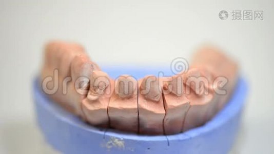 牙科技师，为种植牙提供3D打印模具视频