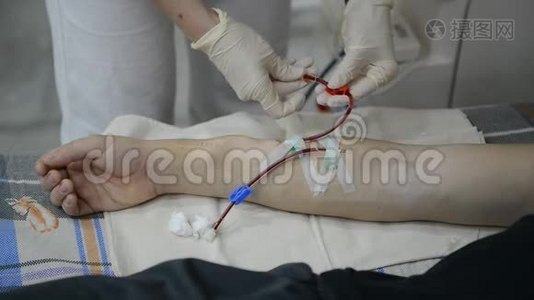 护士准备病人`手臂进行透析视频