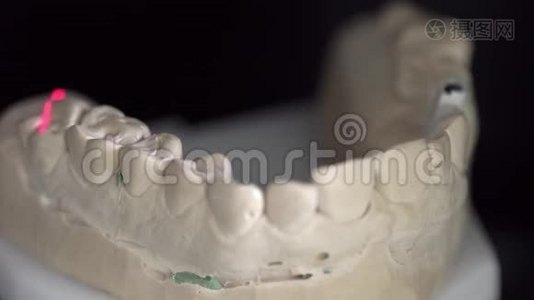 牙科3D扫描仪扫描过程中的特写镜头视频