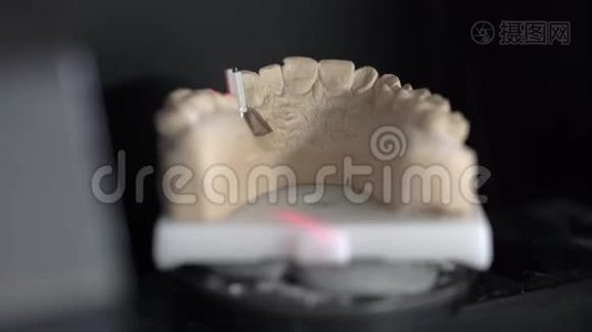 牙科三维扫描仪扫描过程中的观察视频