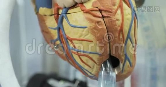 人工血液循环，人`人工心脏，心脏模型。 捐助者之心视频