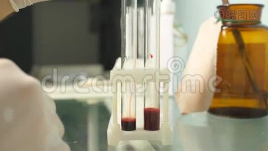化验血样。 实验室男医生手用血液在试管中加入过氧化氢。 快关门视频