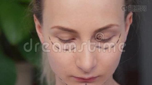 女性面部整形手术痕迹视频