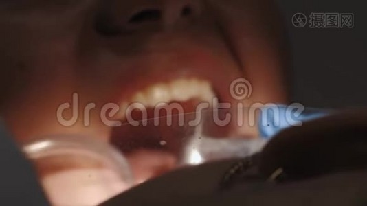 牙医给一个女性病人做牙科治疗。视频