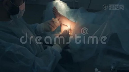 手术室医院踝部湿瘤切除手术。视频