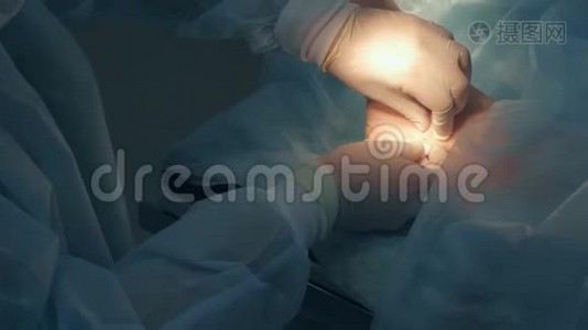 手术室医院踝部湿瘤切除手术。视频