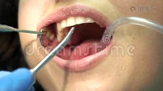 牙科用水注射器。视频