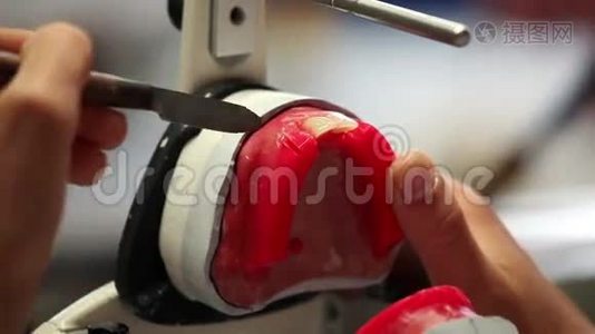 牙科假体的研制视频