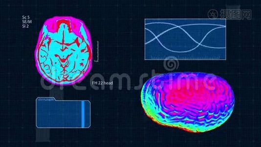 未来派医疗界面。 脑MRT扫描。 全高清医学彩色背景视频