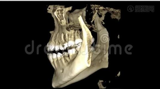 口腔医学、牙科研究、新质量医学、牙科影像动画的人颌骨成像扫描视频