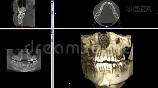 口腔医学、牙科研究、新质量医学、牙科影像动画的人颌骨成像扫描视频