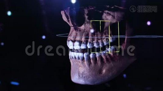 3D牙科数字建模修复.. 三维牙齿模型，病人扫描牙齿。 医生正在研究视频