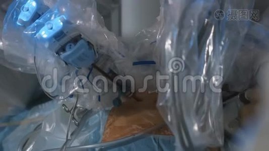 现代医学外科机器人，肿瘤切除手术机器人手术视频