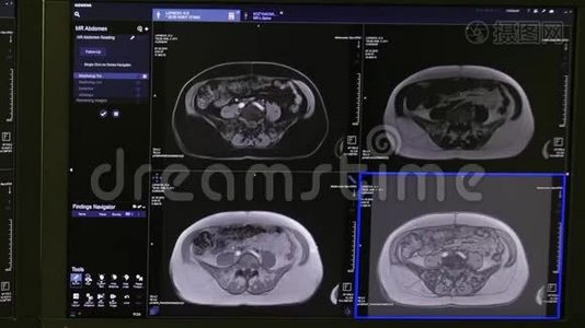核磁共振扫描的脑部断层扫描。视频