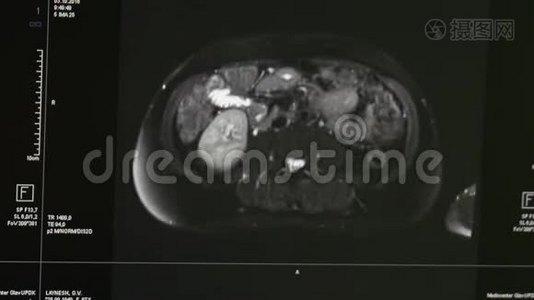 专业医疗设备MRI扫描的脑部断层扫描。视频