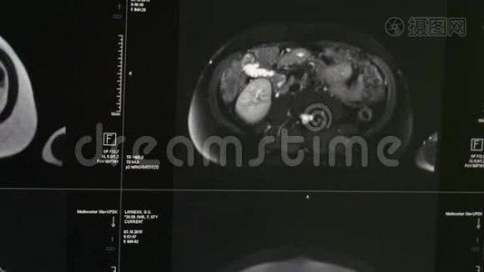 专业医疗设备MRI扫描的脑部断层扫描。视频