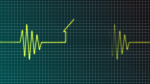 心电图光效10秒视频