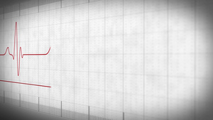 心电图脉冲波形29秒视频