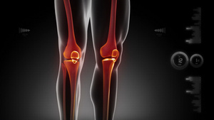膝盖扫描背景视频15秒视频