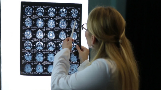 专业女医生在实验室检查MRI断层扫描图像视频
