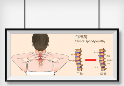 颈椎病科普医疗插画图片