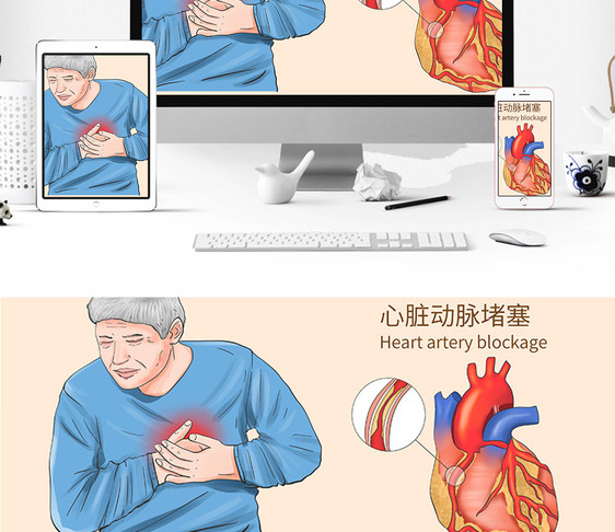 心脏动脉堵塞科普医疗插画图片