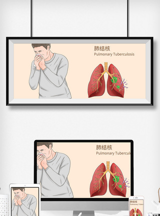 肺结核病科普医疗插画图片