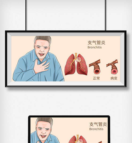 支气管炎科普医疗插画图片