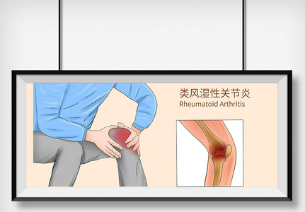 类风湿性关节炎科普医疗插画高清图片