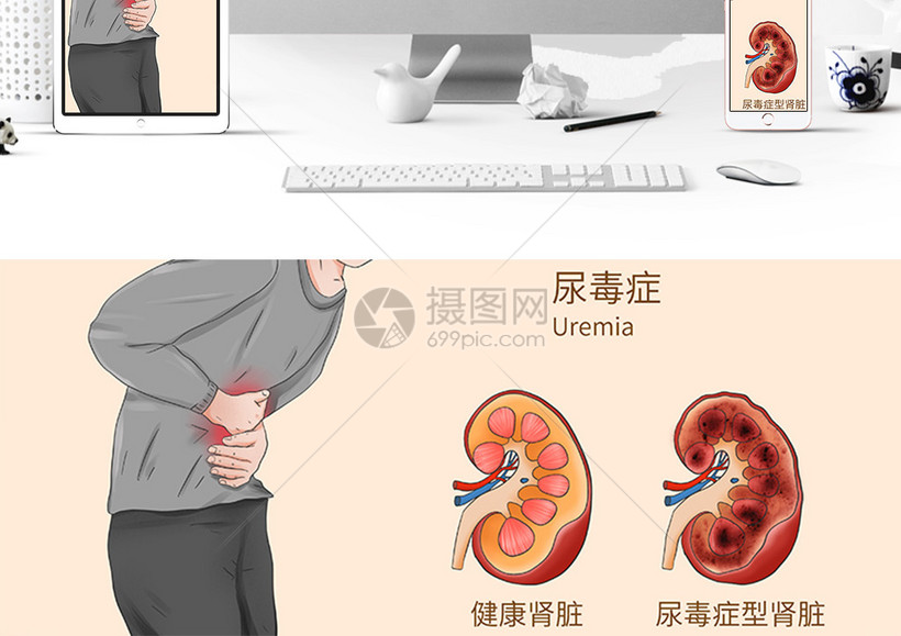 经典的尿毒症有些什么症状的视图