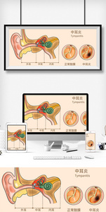中耳炎科普医疗插画图片