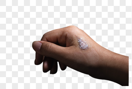 伤口元素_免抠素材_png图片下载-摄图网