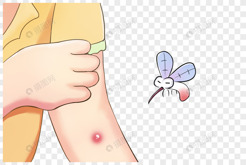 蚊虫叮咬