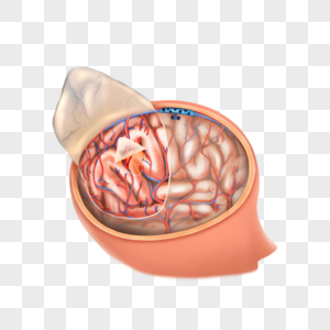 脑膜医疗脑膜高清图片