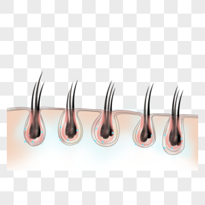 植发毛囊头发营养高清图片