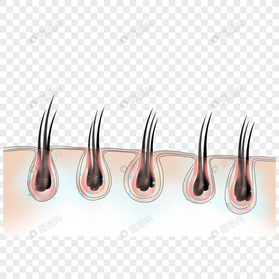 植发毛囊图片