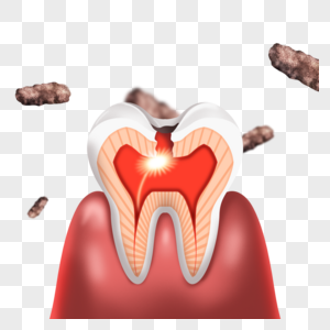 蛀牙细菌光效牙齿健康图片