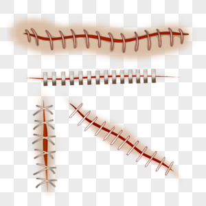 手术伤口缝合卡通红色医疗高清图片