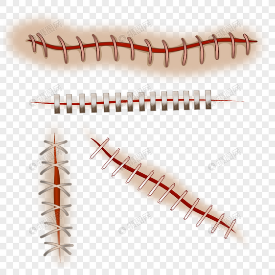 手术伤口缝合卡通红色医疗图片