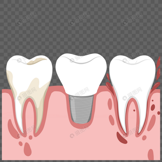牙齿口腔卫生矢量元素图片